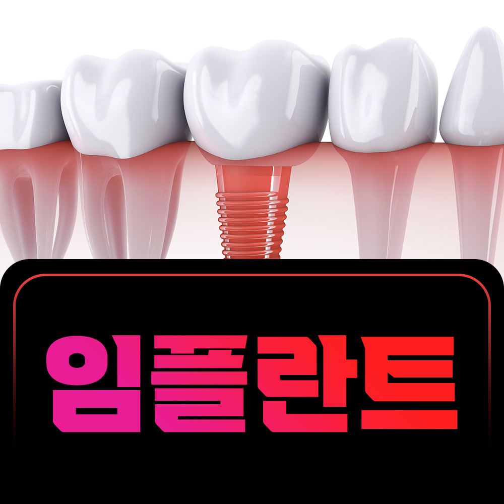 임플란트