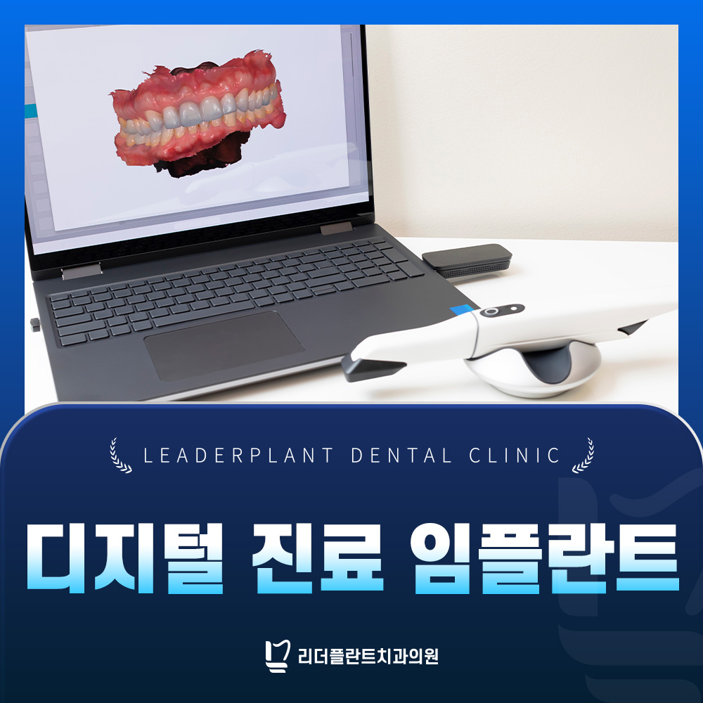 디지털 진료 임플란트